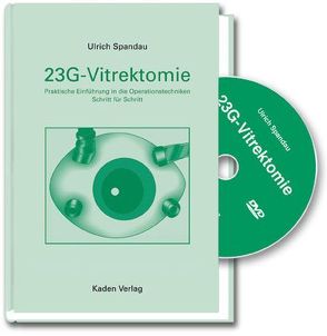 23G-Vitrektomiie von Spandau,  Ulrich