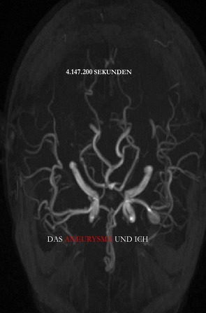 4.147.200 Sekunden – Das Aneurysma und ich von Wendtland,  Anja