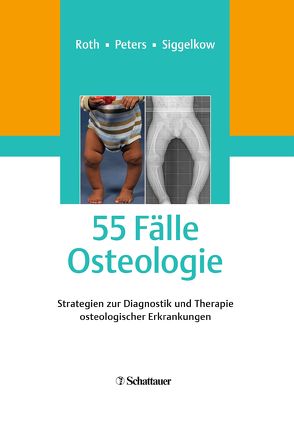 55 Fälle Osteologie von Peters,  Klaus M., Roth,  Andreas, Siggelkow,  Heide