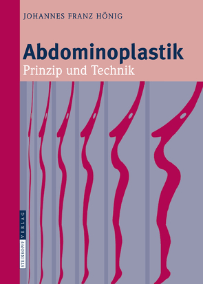 Abdominoplastik von Hönig,  Johannes-Franz