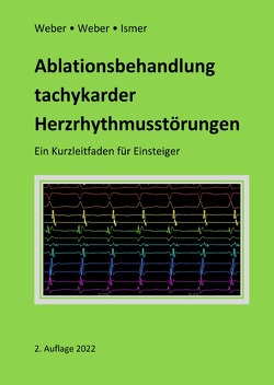 Ablationsbehandlung tachykarder Herzrhythmusstörungen von Weber,  Frank