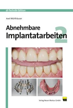 Abnehmbare Implantatarbeiten 2 von Mühlhäuser,  Axel