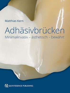 Adhäsivbrücken von Kern,  Matthias