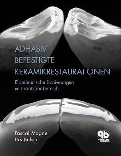 Adhäsiv befestigte Keramikrestaurationen im Frontzahnbereich von Belser,  Urs C., Magne,  Pascal