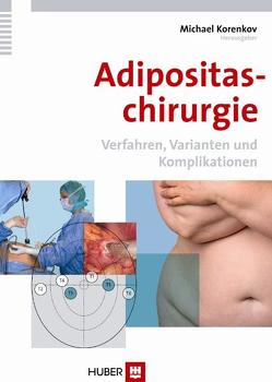 Adipositaschirurgie von Korenkov,  Michael