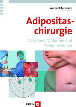 Adipositaschirurgie von Korenkov,  Michael