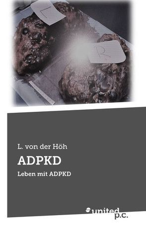 ADPKD von von der Höh,  L.