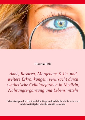 Akne, Rosacea, Morgellons & Co. und weitere Erkrankungen, verursacht durch synthetische Celluloseformen in Medizin, Nahrungsergänzung und Lebensmitteln von Ehle,  Claudia