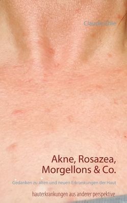 Akne, Rosazea, Morgellons & Co. von Ehle,  Claudia