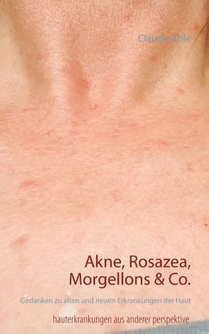 Akne, Rosazea, Morgellons & Co. von Ehle,  Claudia