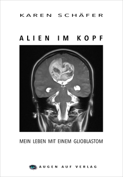 Alien im Kopf von Schäfer,  Karen