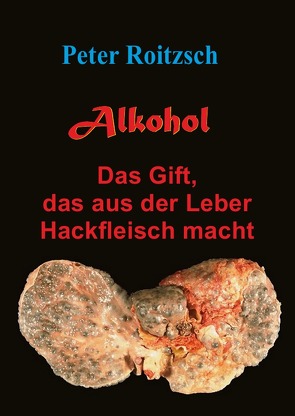 Alkohol – Das Gift, das aus der Leber Hackfleisch macht von Roitzsch,  Peter