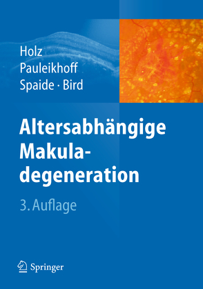 Altersabhängige Makuladegeneration von Bird,  A.C., Holz,  Frank G., Pauleikhoff,  Daniel, Spaide,  R.F.