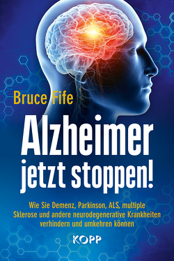 Alzheimer jetzt stoppen! von Fife,  Bruce