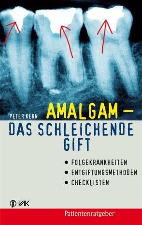 Amalgam – das schleichende Gift von Kern,  Peter