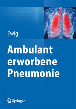 Ambulant erworbene Pneumonie von Ewig,  Santiago