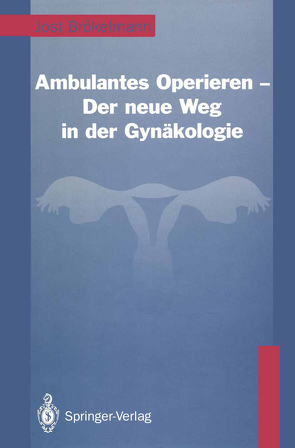 Ambulantes Operieren — Der neue Weg in der Gynäkologie von Brökelmann,  Jost