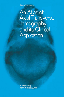 An Atlas of Axial Transverse Tomography and its Clinical Application von Takahashi,  Shinji