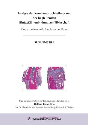 Analyse der Knochenbruchheilung und der begleitenden Blutgefäßneubildung am Tibiaschaft von Tilp,  Susanne