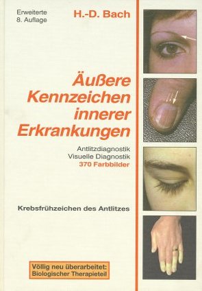 Antlitzdiagnostik / Äussere Kennzeichen innerer Erkrankungen von Bach,  Hans D