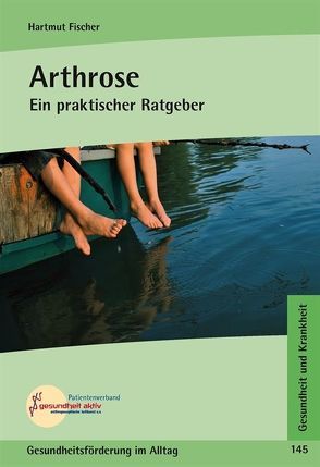 Arthrose von Fischer,  Hartmut