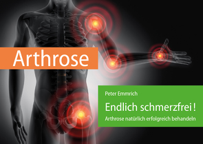 Arthrose – Endlich schmerzfrei! von Emmrich,  Peter