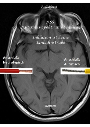 ASS Autismus-Spektrums-Segnung – Asperger-Syndrom, Sucht, Alkoholismus, Spiritualität, Buddhismus von Horst,  Rolf