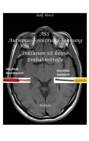 ASS Autismus-Spektrums-Segnung – Asperger-Syndrom, Sucht, Alkoholismus, Spiritualität, Buddhismus von Horst,  Rolf