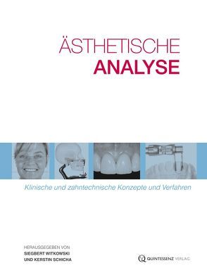 Ästhetische Analyse von Barducci,  Giancarlo, Bellmann,  Jan-Holger, Blatz,  Markus B., Brouillet,  Jean-Louis, Chiche,  Gerard J, Faucher,  André-Jean, Fehmer,  Vincent, Fradeani,  Mauro, Hannker,  Christian, Hein,  Sascha, Kunz,  Andreas, Langner,  Jan, Larmy,  Annick, Lee,  Samuel C., Leukhardt,  Markus, Lotz,  Hans-Joachim, Massironi,  Domenico, Mink,  Hardi, Navarro,  Carlos F., Ortet,  Stéphanie, Paris,  Jean-Christophe, Pascetta,  Romeo, Passia,  Nicole, Plaster,  Udo, Romeo,  Giuseppe, Schicha,  Kerstin, Schönenberger,  Alwin, Schöttl,  Rainer, Schunke,  Stefan, Skinazi,  Georges L. S., Strub,  Jörg Rudolf, Villanueva,  Jorge A., Witkowski,  Siegbert, Yamazaki,  Masao