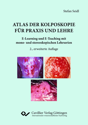 Atlas der Kolposkopie für Praxis und Lehre von Seidl,  Stefan