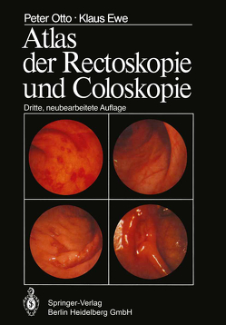 Atlas der Rectoskopie und Coloskopie von Ewe,  K., Otto,  P.