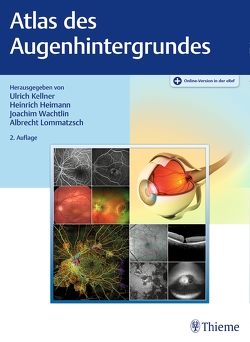 Atlas des Augenhintergrundes von Heimann,  Heinrich, Kellner,  Ulrich, Lommatzsch,  Albrecht Peter, Wachtlin,  Joachim