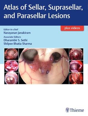 Atlas of Sellar, Suprasellar, and Parasellar Lesions von Janakiram,  Narayanan, Sethi,  Dharambir, Sharma,  Shilpee Bhatia