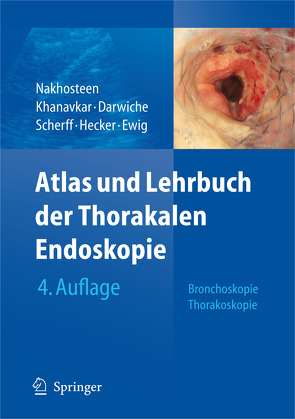 Atlas und Lehrbuch der Thorakalen Endoskopie von Darwiche,  Kaid, Ewig,  Santiago, Hecker,  Erich, Khanavkar,  Barbara, Nakhosteen,  John A., Scherff,  Andreas