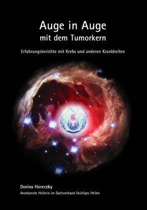 Auge in Auge mit dem Tumorkern von Horeczky,  Dorina