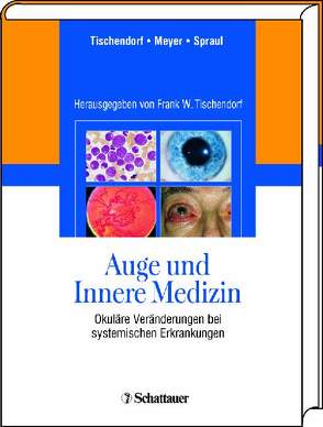 Auge und Innere Medizin von Meyer,  Carsten, Spraul,  Christoph W., Tischendorf,  Frank W