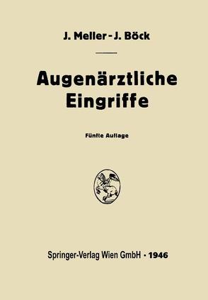 Augenärztliche Eingriffe von Böck,  Josef, Meller,  Josef