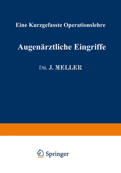 Augenärztliche Eingriffe von Böck,  Josef, Meller,  Josef