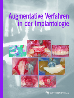 Augmentative Verfahren in der Implantologie von Khoury,  Fouad