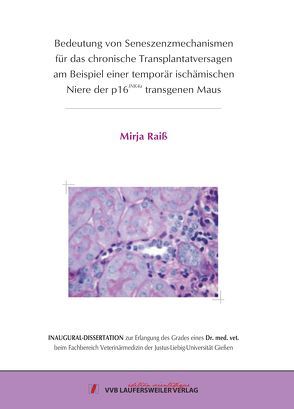 Bedeutung von Seneszenzmechanismen für das chronische Transplantatversagen am Beispiel einer temporär ischämischen Niere der p16INK4a transgenen Maus von Raiß,  Mirja