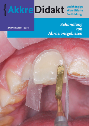 Behandlung von Abrasionsgebissen von Lobbezoo,  Frank, Loomans,  Bas A. C., Opdam,  Niek, Wetselaar,  Peter