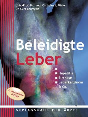 Beleidigte Leber von Baumgart,  Gert, Müller,  Christian J.