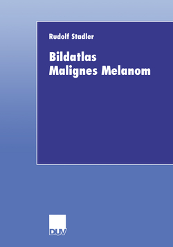 Bildatlas Malignes Melanom von Stadler,  Rudolf