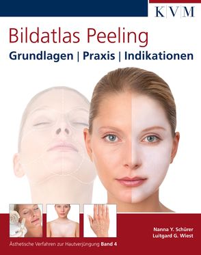 Bildatlas Peeling von Schürer,  Nanna Y., Wiest,  Luitgard G.