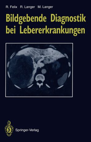 Bildgebende Diagnostik bei Lebererkrankungen von Barzen,  G., Bassir,  C., Felix,  Roland, Keske,  U., Langer,  Mathias, Langer,  Ruth, Neuhaus,  P., Rosenkranz,  K., Schulz,  E.