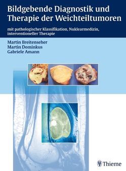 Bildgebende Diagnostik und Therapie der Weichteiltumoren von Abdolvahab,  Farshid, Amann,  Gabriele, Breitenseher,  Martin, Brodowicz,  Thomas, Dominkus,  Martin