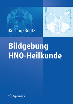 Bildgebung HNO-Heilkunde von Bootz,  Friedrich, Kösling,  Sabrina