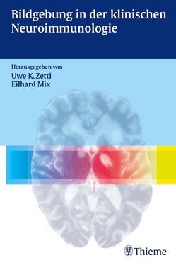 Bildgebung in der klinischen Neuroimmunologie von Adler,  Silke, Becker,  Georg, Benecke,  Reiner, Mix,  Eilhard, Zettl,  Uwe Klaus