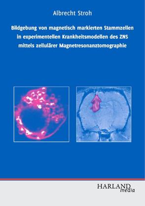 Bildgebung von magnetisch markierten Stammzellen in experimentellen Krankheitsmodellen des ZNS mittels zellulärer Magnetresonanztomographie von Stroh,  Albrecht