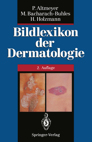 Bildlexikon der Dermatologie von Altmeyer,  Peter, Bacharach-Buhles,  Martina, Buhles,  N., Holzmann,  Hans